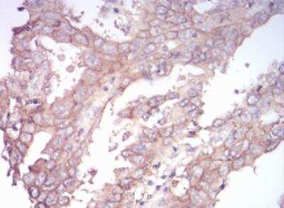 Immunohistochemistry-Paraffin: Sphingosine Kinase 2/SPHK2 Antibody (9C5E1) - BSA Free [NBP2-52567]