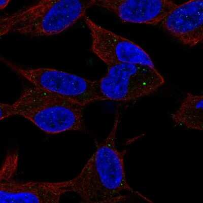 Immunocytochemistry/ Immunofluorescence: Sphingosine Kinase 2/SPHK2 Antibody [NBP2-57035]