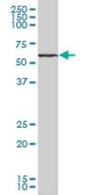 Western Blot: Sphingosine Kinase 2/SPHK2 Antibody [H00056848-B01P]