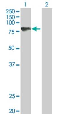 Western Blot: Sphingosine Kinase 2/SPHK2 Antibody [H00056848-B01P]