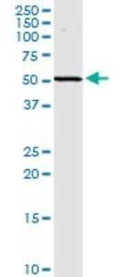 Western Blot: Sphingosine Kinase 2/SPHK2 Antibody [H00056848-D01P]