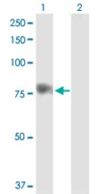 Western Blot: Sphingosine Kinase 2/SPHK2 Antibody [H00056848-D01P]