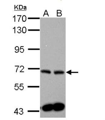 Western Blot: Sphingosine Kinase 2/SPHK2 Antibody [NBP1-33085]