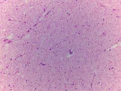 Hematoxylin & Eosin Stain: Spinal Cord Tissue Slides (Adult Normal)- Frozen [NBP2-77559]