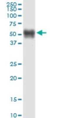 Western Blot: Spinesin Antibody (2E5) [H00080975-M09]