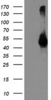 Western Blot: Spinesin Antibody (OTI4A11) [NBP2-01126]