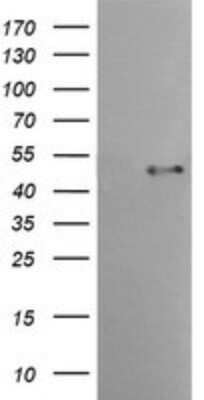 Western Blot: Spinesin Antibody (OTI4G4)Azide and BSA Free [NBP2-74337]