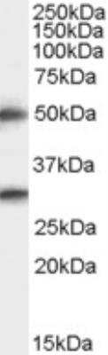 Western Blot: Spinesin Antibody [NB100-896]