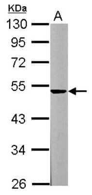 Western Blot: Spinesin Antibody [NBP2-20474]