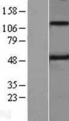 Western Blot: Spinesin Overexpression Lysate [NBL1-17126]