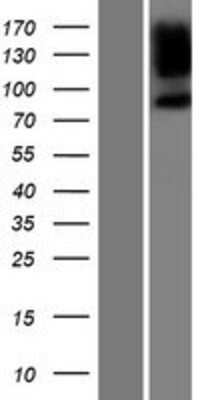 Western Blot: PPP1R9B/Spinophilin Overexpression Lysate [NBP2-05991]