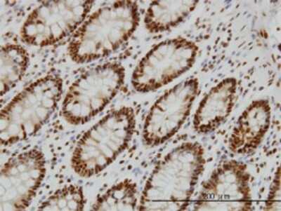 Immunohistochemistry-Paraffin: Splicing Factor 1 Antibody (2E12) [H00007536-M01]