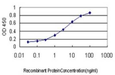 ELISA: Splicing Factor 1 Antibody (2E12) [H00007536-M01]