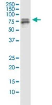 Western Blot: Splicing Factor 1 Antibody (2E12) [H00007536-M01]