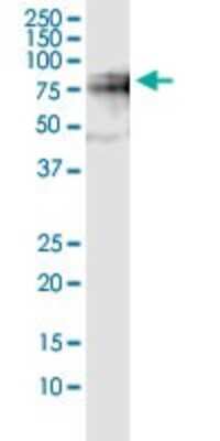 Western Blot: Splicing Factor 1 Antibody (2E12) [H00007536-M01]