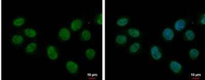 Immunocytochemistry/ Immunofluorescence: Splicing Factor 1 Antibody [NBP1-32583]