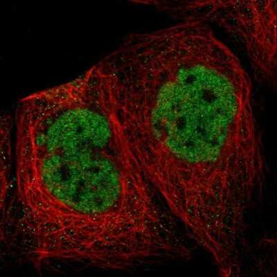 Immunocytochemistry/ Immunofluorescence: Splicing Factor 1 Antibody [NBP1-86835]