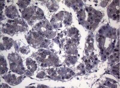 Immunohistochemistry: Splicing Factor 1 Antibody (OTI7H9) - Azide and BSA Free [NBP2-74338]