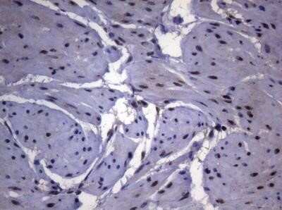 Immunohistochemistry: Splicing Factor 1 Antibody (OTI7H9) - Azide and BSA Free [NBP2-74338]