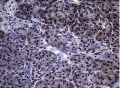 Immunohistochemistry: Splicing Factor 1 Antibody (OTI7H9) - Azide and BSA Free [NBP2-74338]