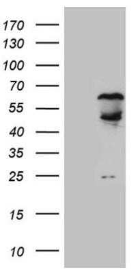 Western Blot: Splicing Factor 1 Antibody (OTI7H9)Azide and BSA Free [NBP2-74338]