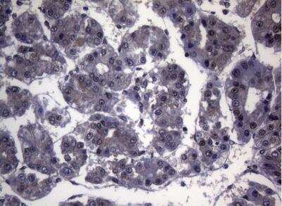 Immunohistochemistry-Paraffin: Splicing Factor 1 Antibody (OTI7H9) [NBP2-45793]