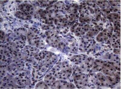 Immunohistochemistry-Paraffin: Splicing Factor 1 Antibody (OTI7H9) [NBP2-45793]