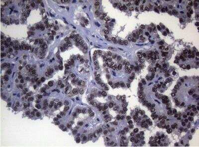 Immunohistochemistry-Paraffin: Splicing Factor 1 Antibody (OTI7H9) [NBP2-45793]