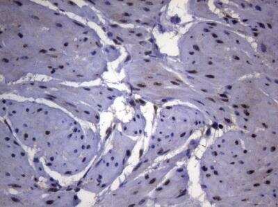 Immunohistochemistry-Paraffin: Splicing Factor 1 Antibody (OTI7H9) [NBP2-45793]