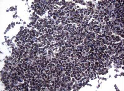 Immunohistochemistry-Paraffin: Splicing Factor 1 Antibody (OTI7H9) [NBP2-45793]