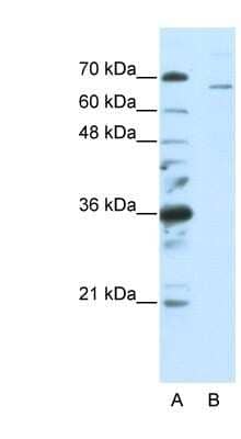 Western Blot: Splicing Factor 1 Antibody [NBP1-57322]