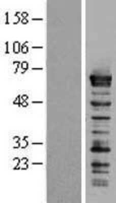 Western Blot: Splicing Factor 1 Overexpression Lysate [NBL1-15873]