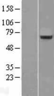 Western Blot: Splicing factor, arginine/serine-rich 11 Overexpression Lysate [NBL1-15888]