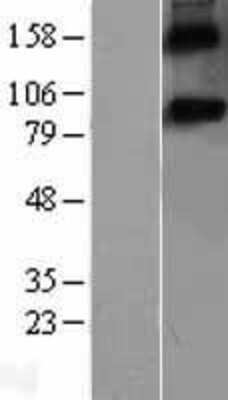 Western Blot: F-Spondin/SPON1 Overexpression Lysate [NBL1-16417]