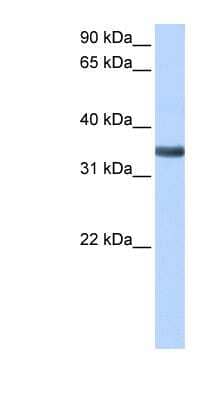 Western Blot: Mindin/Spondin-2 Antibody [NBP1-59177]