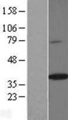 Western Blot: Mindin/Spondin-2 Overexpression Lysate [NBL1-16418]