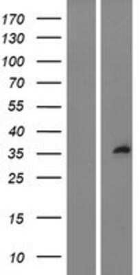 Western Blot: SPRY1 Overexpression Lysate [NBL1-16434]