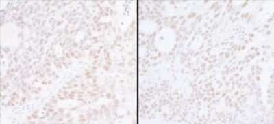 Immunohistochemistry: Spt6 Antibody [NB100-2583]