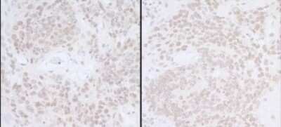 Immunohistochemistry: Spt6 Antibody [NB100-2583]