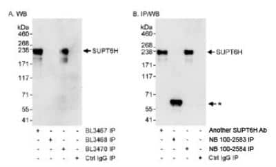 Immunoprecipitation: Spt6 Antibody [NB100-2584]