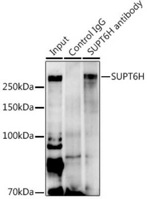 Immunoprecipitation: Spt6 Antibody - Azide and BSA Free [NBP2-93722]