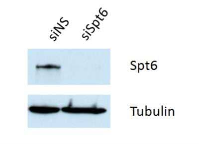 Western Blot: Spt6 Antibody [NB100-2582]