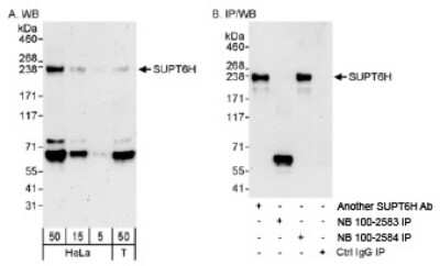 Western Blot: Spt6 Antibody [NB100-2583]