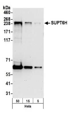 Western Blot: Spt6 Antibody [NB100-2583]