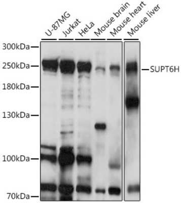 Western Blot: Spt6 AntibodyAzide and BSA Free [NBP2-93722]