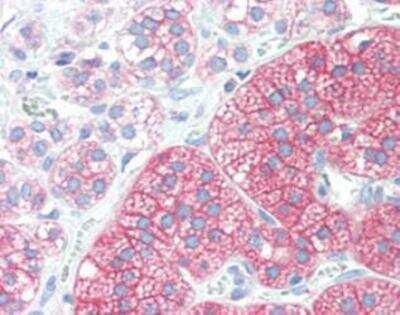 Immunohistochemistry: Src Antibody (5A18) [NBP1-19188]