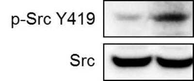 Western Blot: Src Antibody (5A18) [NBP1-19188]