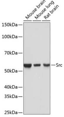 Western Blot: Src Antibody (7G6M9) [NBP3-15675]