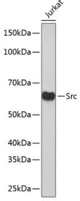 Western Blot: Src Antibody (7G6M9) [NBP3-15675]