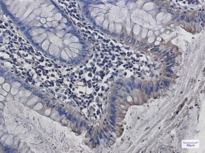 Immunohistochemistry-Paraffin: Src Antibody (S05-7H8) [NBP3-20055]